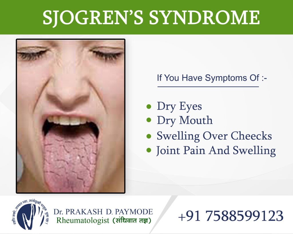 Shogren Syndrome - Dr.PrakashPaymode